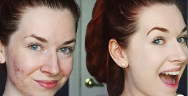 Miya serum rewitalizujące 15 ml - odkryj sekrety pięknej skóry